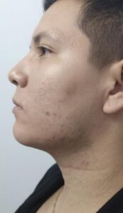 Rostro después