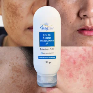 Gel de Ácido Tranexámico 3%  70g